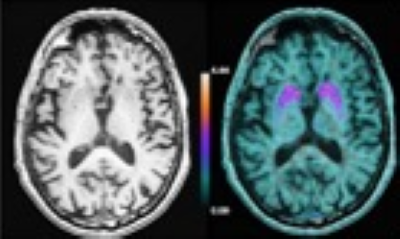 Les Technologies pour la médecine du futur