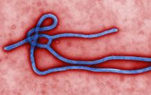 Ebola eZYSCREEN : un test de diagnostic 