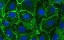 Perméabilité vasculaire : les surprises de la VE-cadherine