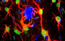 Alzheimer's disease: blocking reactive astrocytes to help neurons