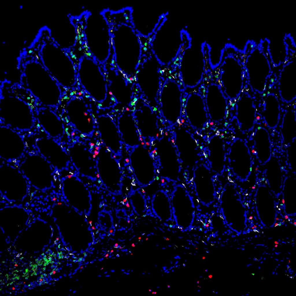 Contrôle du VIH après traitement : le rôle des macrophages intestinaux
