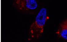 Nanoparticles as enhancers for targeted radiotherapy against breast cancer