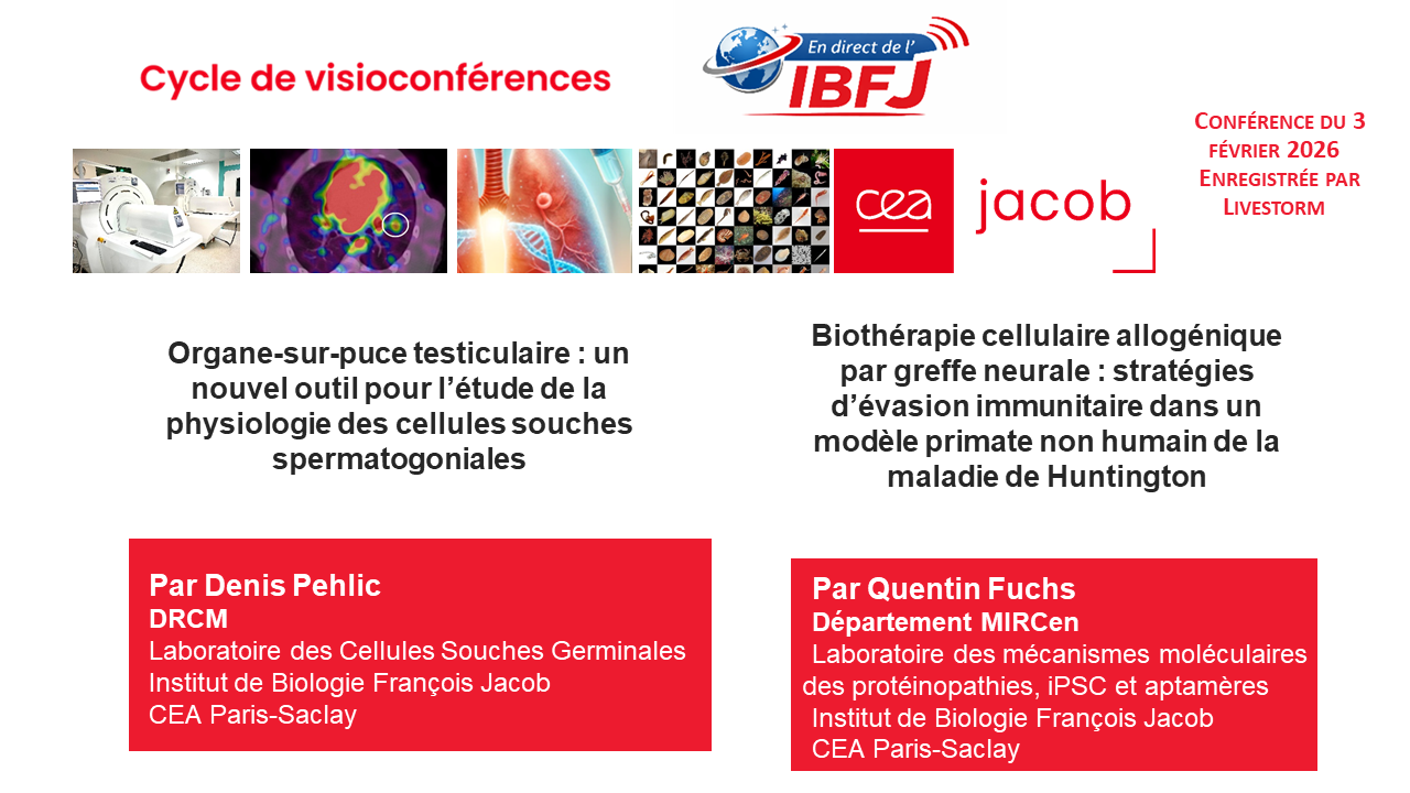 En Direct de l'IBFJ, mardi 3 février 2026