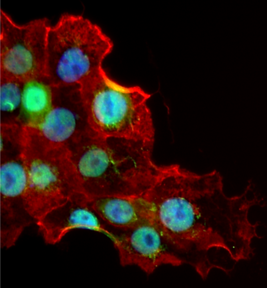 François Jacob Institute of biology Skin grafts KLF4, a new target