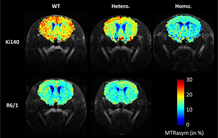 Two technologies are better than one for understanding Huntington's disease