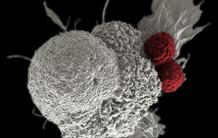 HLA-G : une nouvelle cible thérapeutique anti-cancéreuse