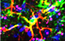 The beneficial role of reactive astrocytes in Huntington's disease