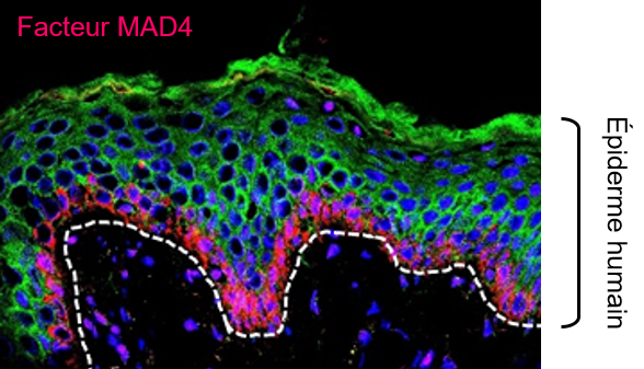 MXD4/MAD4: a target of interest for ex vivo stem cell preservation