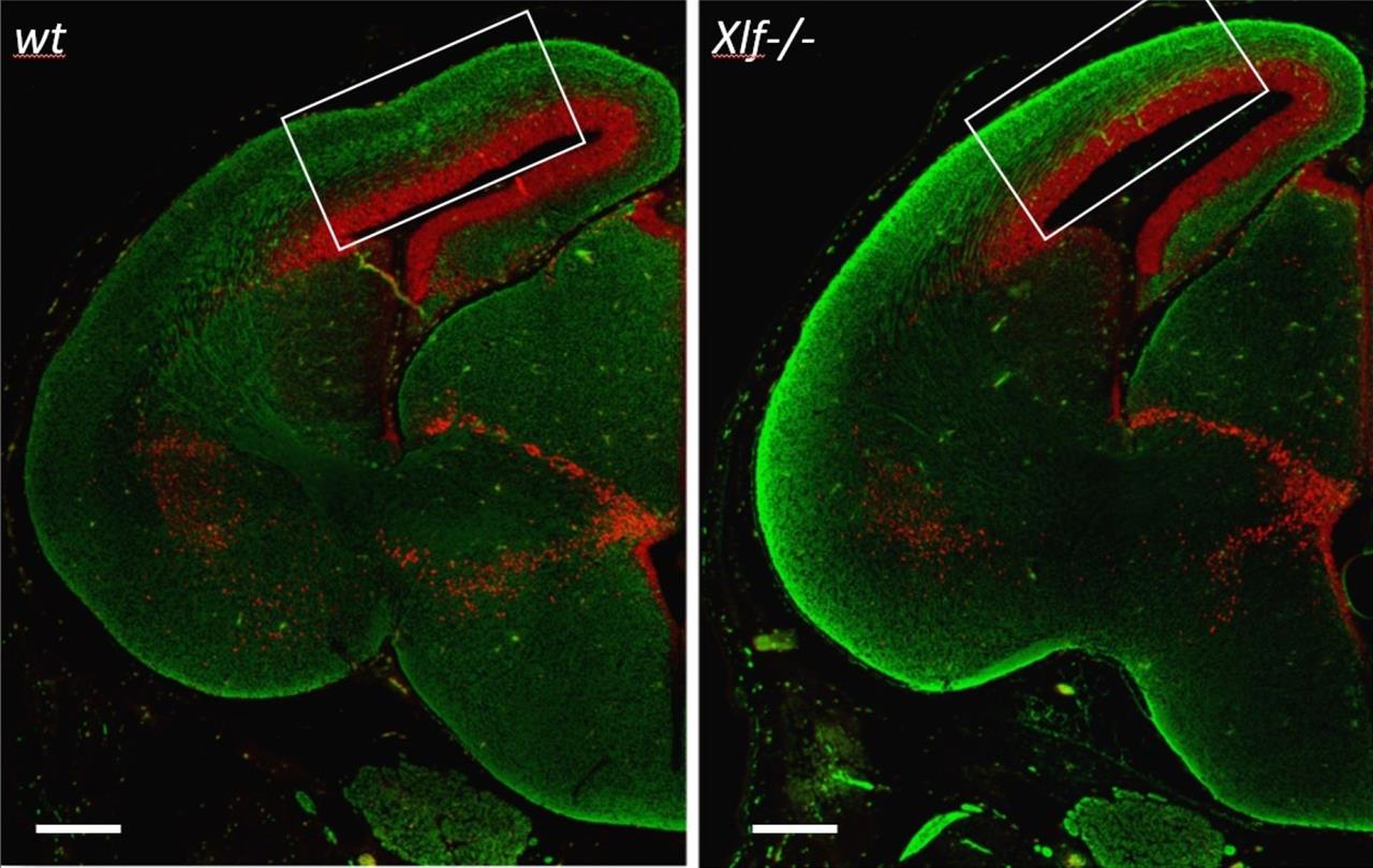 XLF/Cernunnos: premature neurogenesis and delayed brain development