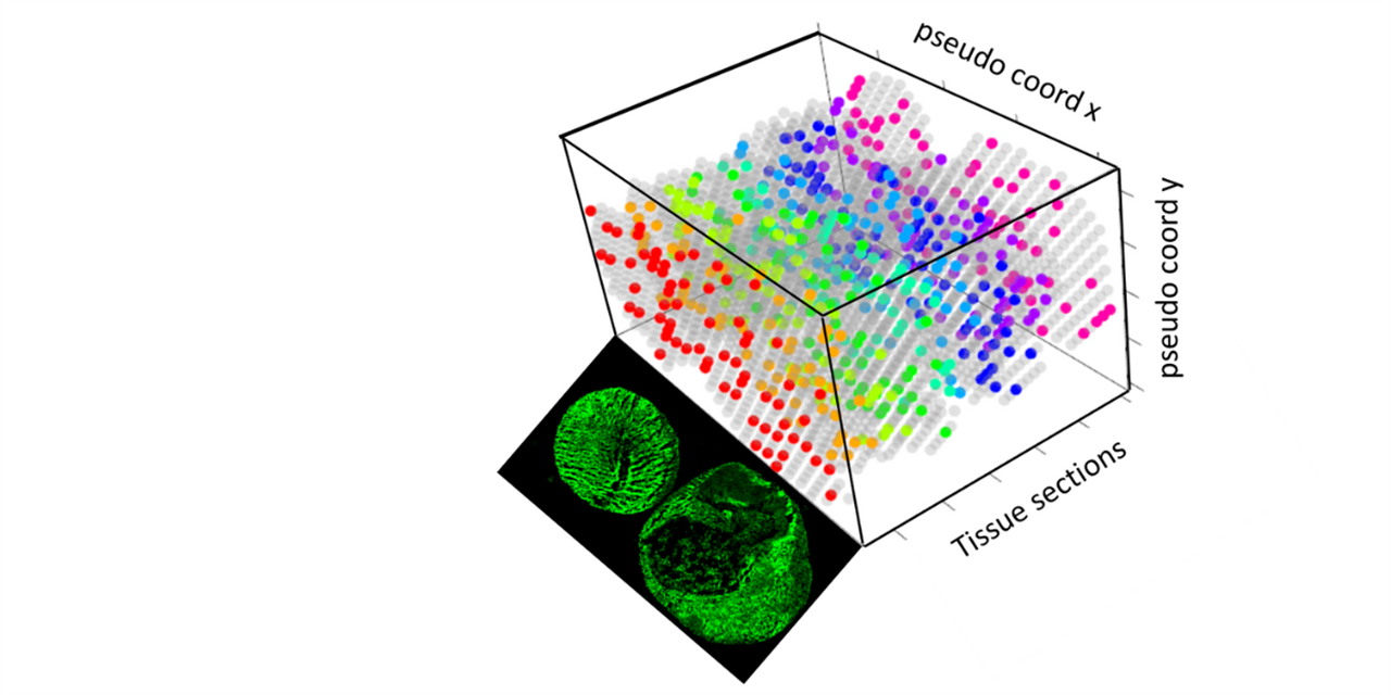 Cartographie 3D des tissus  et expression génique spatiale