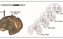 La quantification de l’imagerie cérébrale TEP à l’épreuve de l’histologie 3D