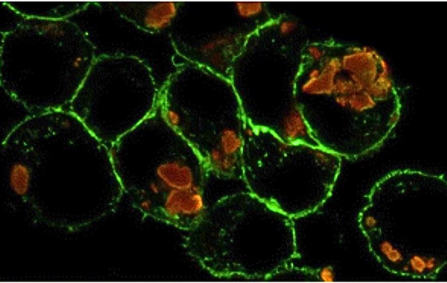 Impact des nanoplastiques sur les cellules immunitaires