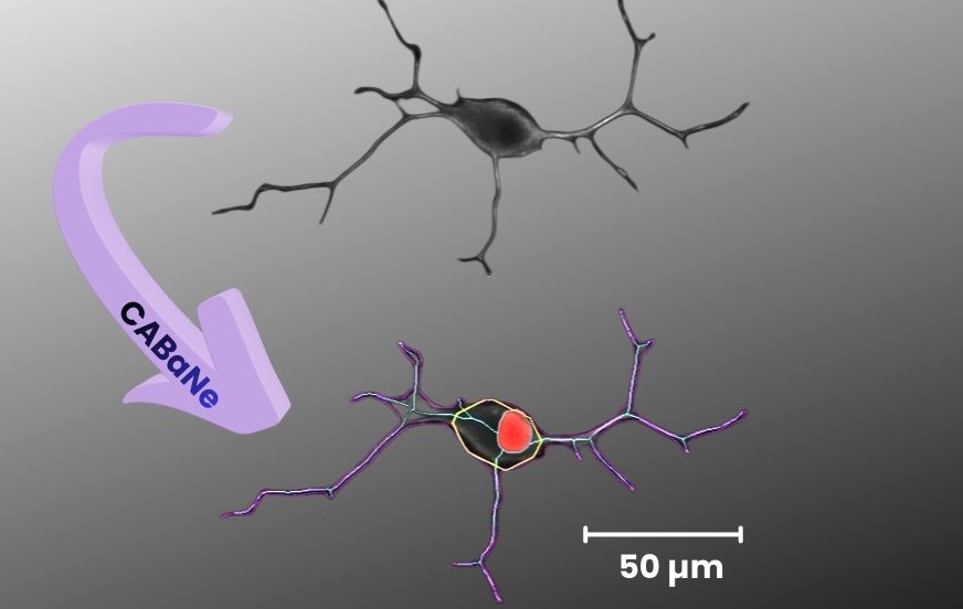 Automated tools transform how neurites are measured