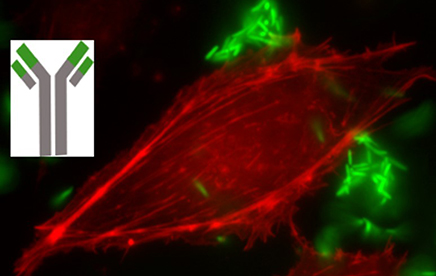 Human monoclonal antibodies to combat bacterial resistance to antibiotics