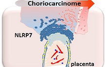 NLRP7 protein disguises placental cancer from the mother