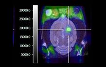 L’hétérogénéité tumorale mesurable en TEP : une première étape vers une validation biologique