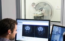 Premier suivi longitudinal d'une immunothérapie contre la maladie d'Alzheimer par IRM microscopique