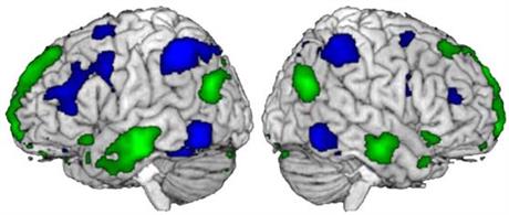 cerveau maths zones activees.JPG