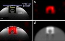 New method for quantifying images in PET / MRI