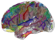 Understanding autism: novel brain imaging study challenges the dominant explanation
