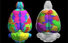 An atlas of the rat brain to better understand the human brain