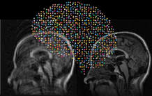 Deep learning en IRM : un standard pour comparer les performances des réseaux de neurones artificiels