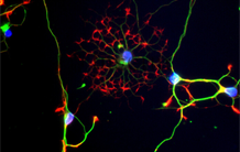 Diffusion MRI to monitor astrocyte activity?