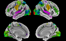 Analysis of multitask functional MRI data for the establishment of a neurocognitive atlas of the human brain