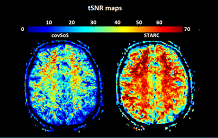 Signal optimization in very high field functional MRI