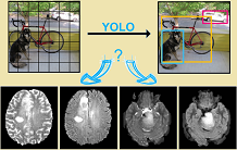 Segmentation of rare brain tumors in MR imaging