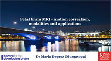 Fetal brain MRI - motion corrections, modalities and applications