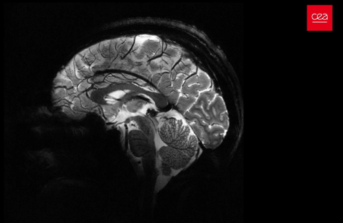 ERC Starting Grant pour Charles Laïdi à NeuroSpin!