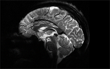 ERC Starting Grant pour Charles Laïdi à NeuroSpin!