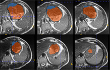 Focus sur la plateforme d’imagerie in vivo de BioMaps et son expertise au service de la lutte contre l’obésité. 