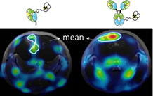 PET imaging of an antibody targeting endothelin receptors in glioblastoma tumors