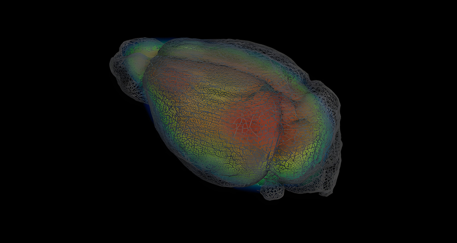 La TEP révèle les effets de la kétamine sur la plasticité synaptique dans un modèle de dépression