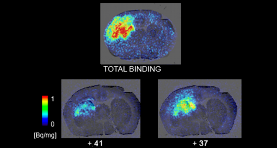 Développement de radioligands pour l’imagerie TEP de la neuroinflammation