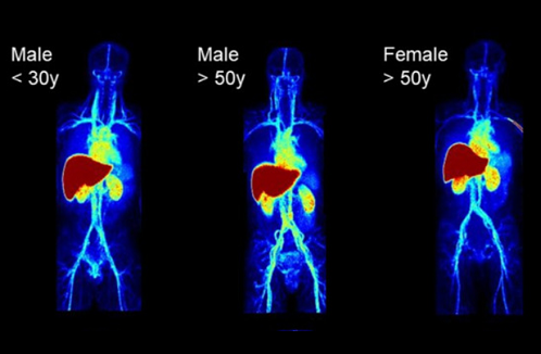 PET imaging of OATP function : impacts of sex and age