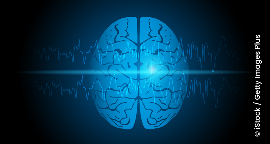 Epilepsy: AI facilitates the delineation of seizure-onset zones.