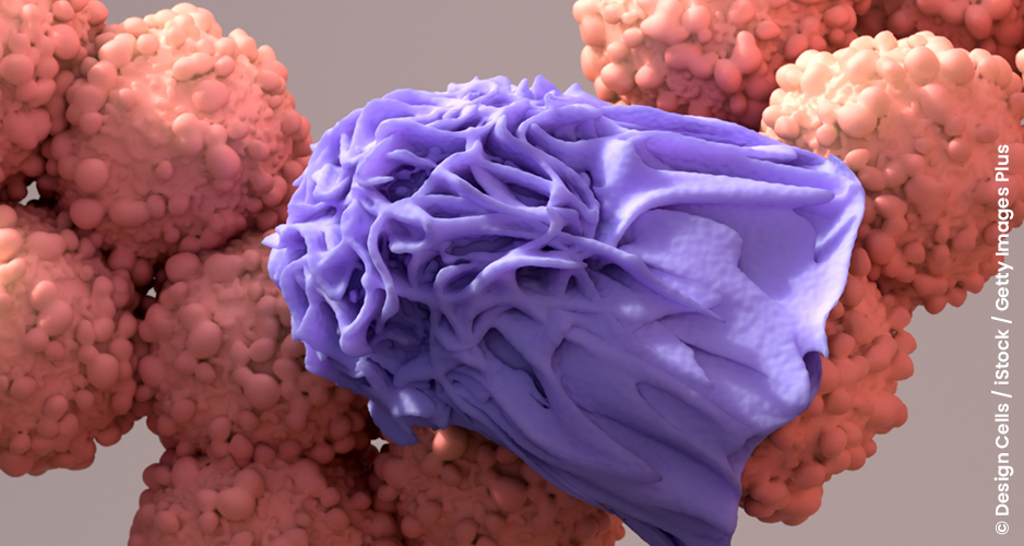 Vers une immunothérapie cellulaire basée sur les CAR-macrophages pour traiter certains cancers solides ?