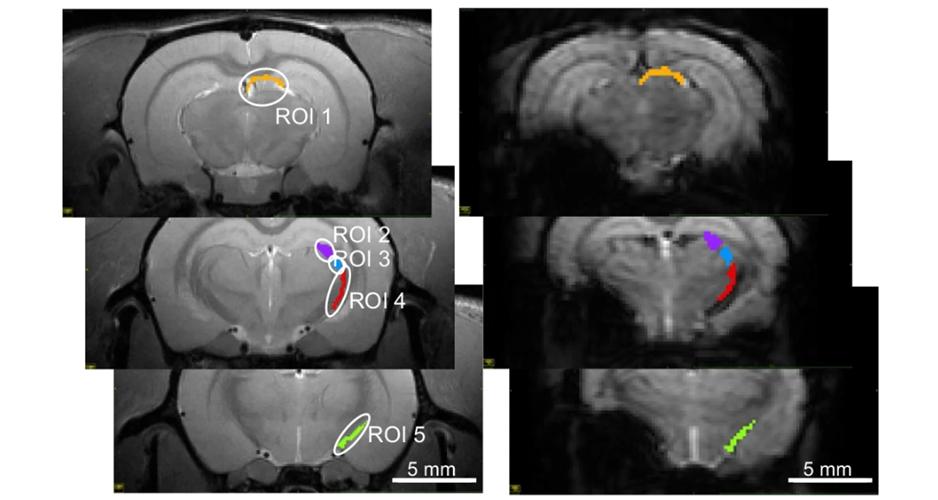 Does the propagation of action potentials in white matter require a local increase in blood flow?