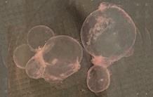 Study of hypoxic brain injury in a human choroid plexus organoid model