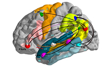 Imaging-genetics approaches to study the normal and pathological human brain