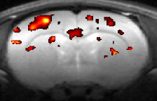 Diffusion functional MRI: direct approach to detect the brain function