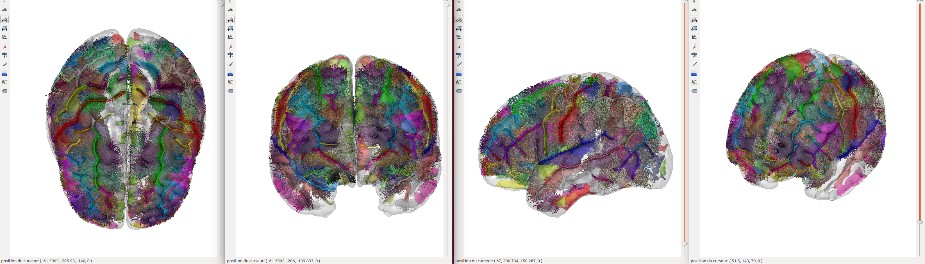 image cerveau 4.jpg