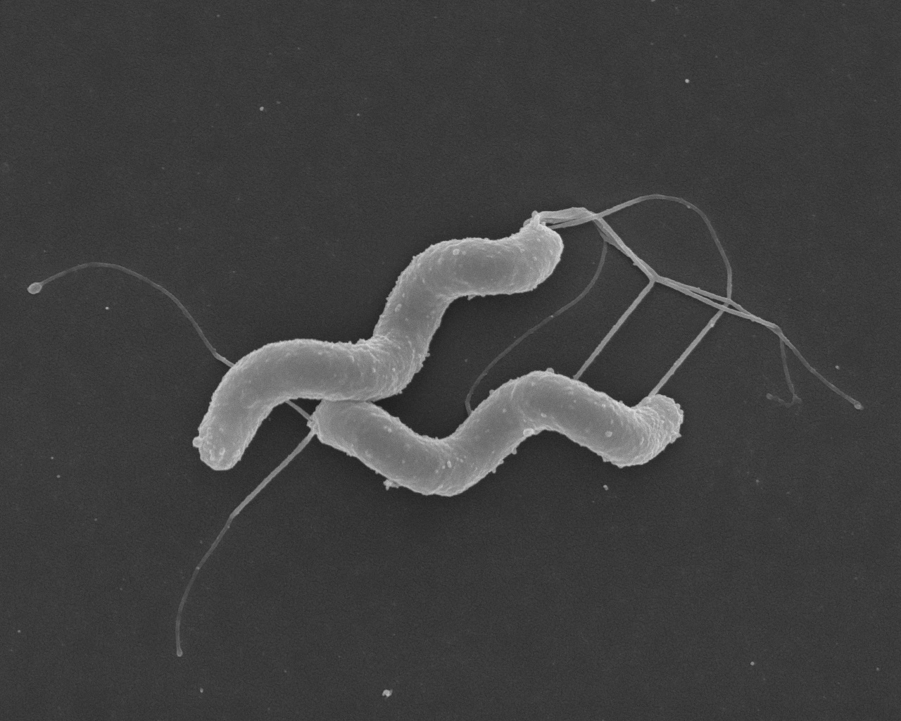 Helicobacter pylori 2.jpg