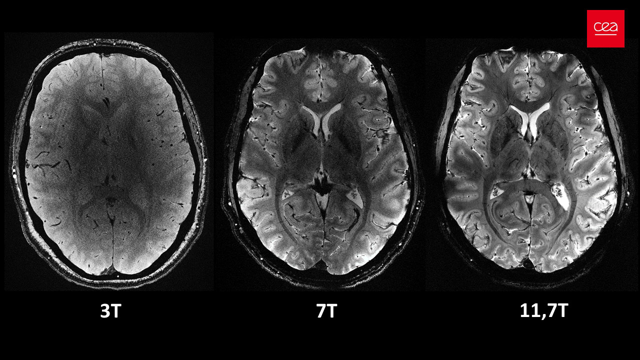 	
Primeras imágenes del cerebro tomadas con el escáner de resonancia magnética más potente del mundo 