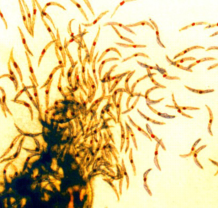 Les sporozoïtes du paludisme, la forme infectieuse active du parasite du paludisme qui est injectée à l'humain par les moustiques, en microscopie.