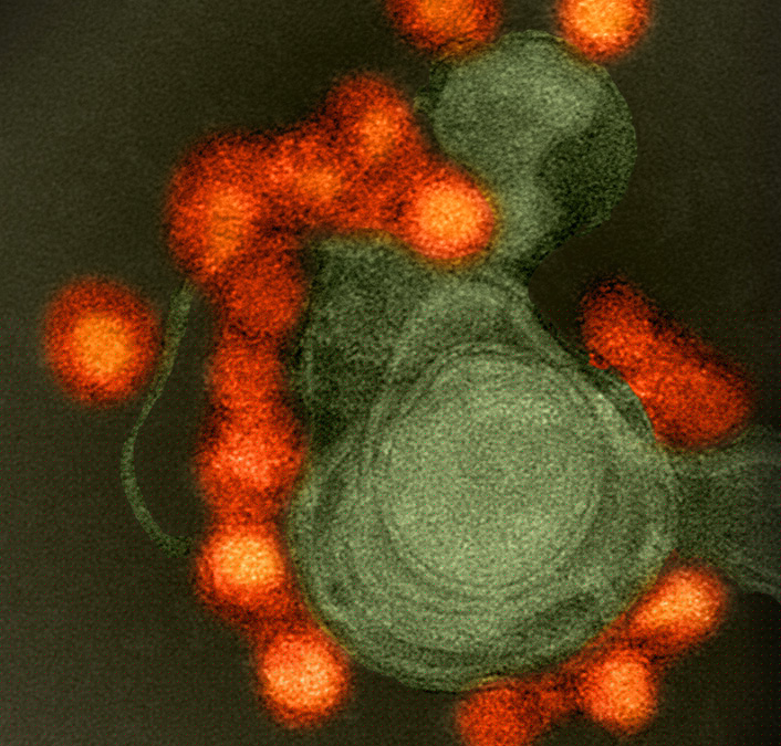 Souche du virus Zika (rouge), isolée d'un cas de microcéphalie au Brésil, en microscopie.