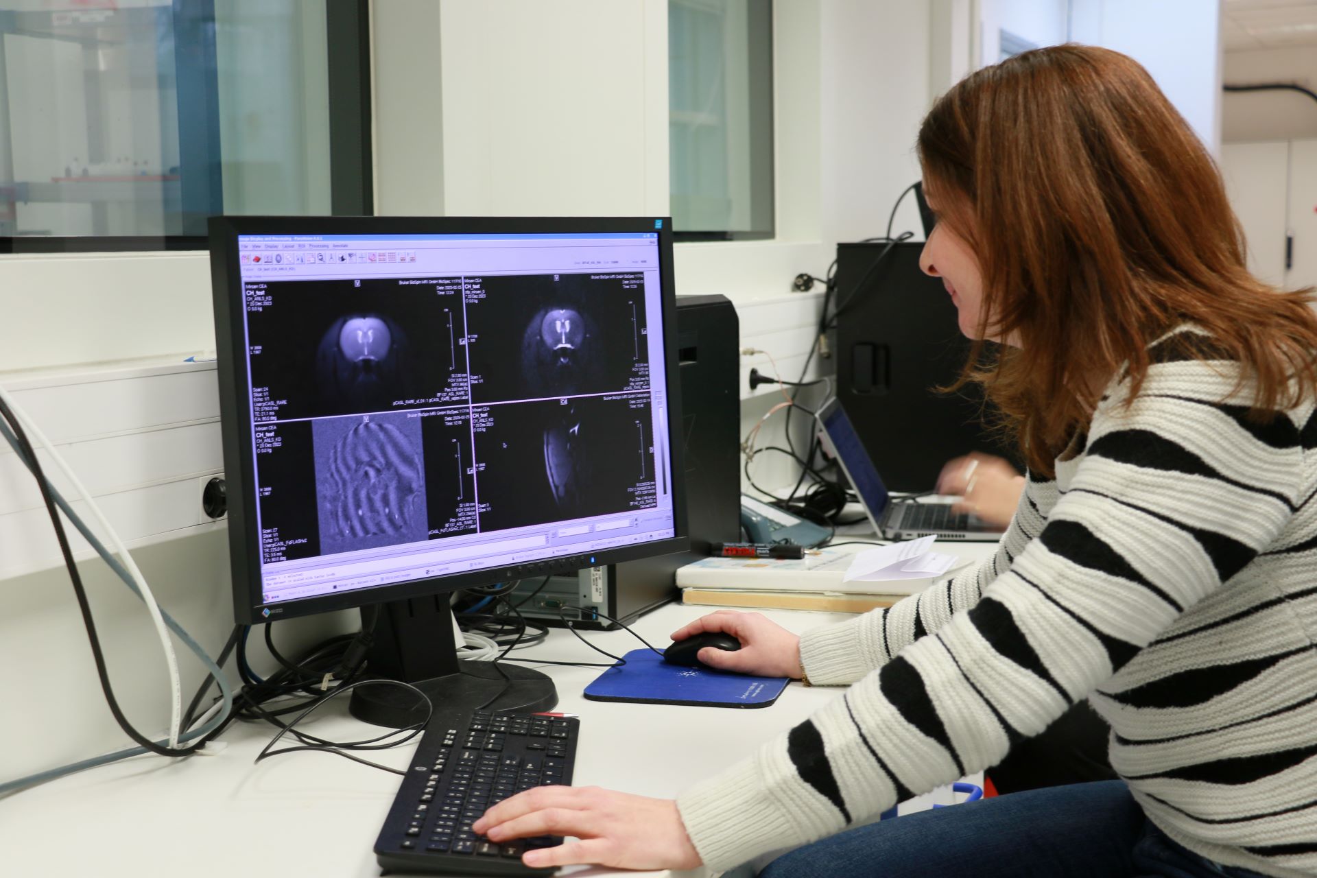 Étudier l'activité du cerveau par l'IRM